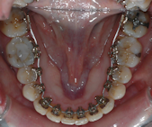 Orthodontiste Monfort